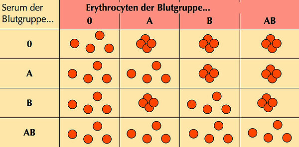 Landsteiners Versuche mit verschiedenen Blutgruppen