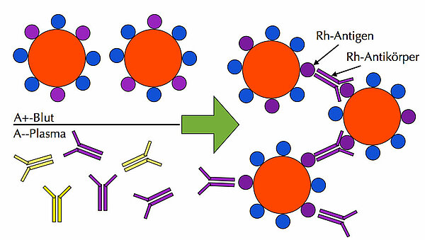 Blut der Blutgruppe A+ wird mit Plasma der Blutgruppe A- gemischt